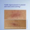 iS CLINICAL Super Serum Advance+, Anti-Aging Vitamin C Face Serum, reduces scaring and fine stretch marks - Image 3